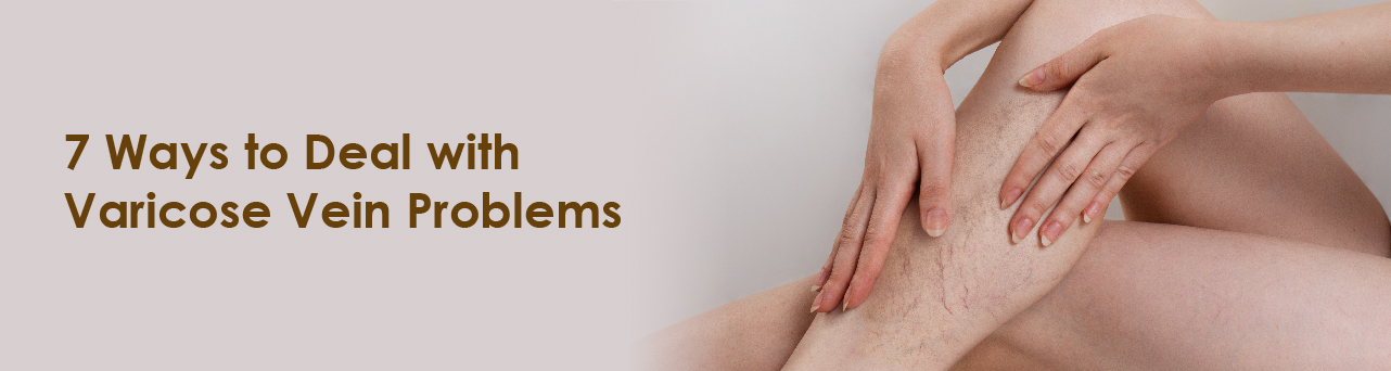 7 Ways to Deal with Varicose Vein Problems